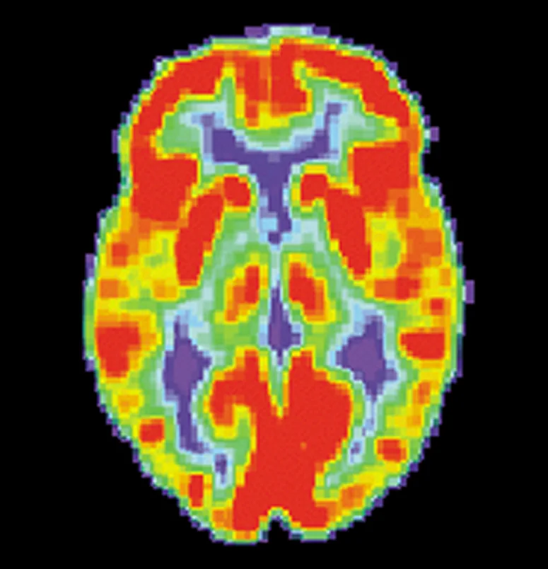 An axial brain scan on a black background, rendered in bright false colour. A thick red and orange band traces the folded outer cortex and runs down the midline, with yellow, green and blue-green regions filling the interior and deep blue-violet patches marking the central fluid spaces. The outline is unmistakably a human brain seen from above.